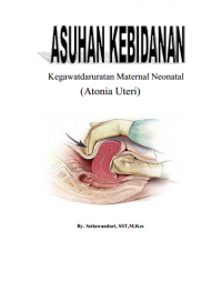 Atonia Uteri Dan Penatalaksanaannya (Kebidanan)